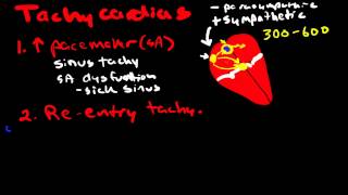 Pathophysiology of Cardiac Arrhythmias [upl. by Berky]