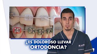 ¿Cuánto dura un tratamiento de ORTODONCIA ¿Es doloroso usar BRACKETS  Shorts [upl. by Avehs]