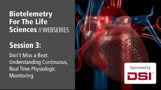 Dont Miss a Beat Understanding Continuous Real Time Physiologic Monitoring [upl. by Eniawed579]