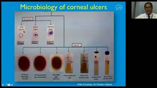 Evaluation of Corneal Ulcers [upl. by Ahouh158]