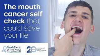 How to do a mouth cancer check at home [upl. by Orvan]