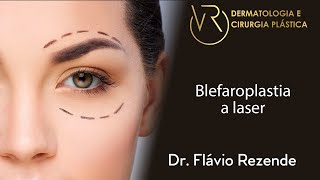 Blefaroplastia a laser  Dr Flávio Rezende [upl. by Kenwood381]