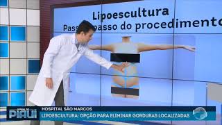 Veja as vantagens de novas técnicas de Lipoescultura [upl. by Wren]