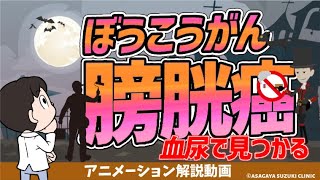 【わかる】膀胱癌（膀胱がん）血尿🩸が出たら必須検査は？原因は🚬？診断と治療 [upl. by Phelgon]