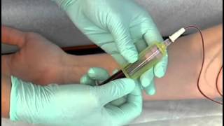 Sample Procedure  Venipuncture Butterfly Method [upl. by Thorvald]