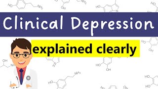 Depression  CAUSES SYMPTOMS ICD10 CRITERIA amp MANAGEMENT [upl. by Curhan]