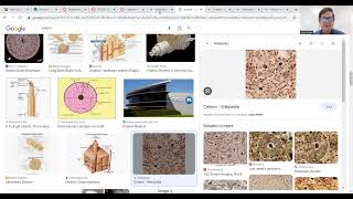 Basic concepts  bone osteon [upl. by Alyekahs105]