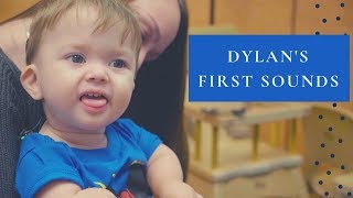 Dylans First Sounds  A Cochlear Implant Journey [upl. by Abra]