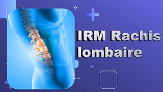 IRM du Rachis lombaire Bonne Pratique [upl. by Yrrep]