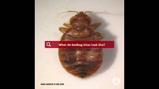 What Do Bedbug Bites Look Like [upl. by Graubert]