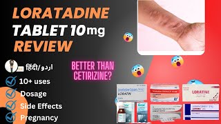 Loratadine  Loratadine 10mg Tablets Used For  Loratadine Tablets 10 mg hindi  Medical Creator [upl. by Airec]