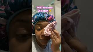 Chalazion problems Chalazion stye eyes health subscribe [upl. by Aryhs429]