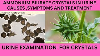 AMMONIUM BIURATE CRYSTALS IN URINECAUSES SYMPTOMS AND TREATMENT OF AMMONIUM BIURATE [upl. by Nailij182]