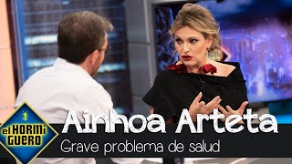 La dura confesión de Ainhoa Arteta sobre su grave problema de salud  El Hormiguero [upl. by Bel]