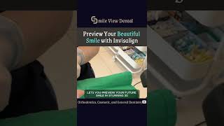 Preview Your Beautiful Smile with Invisalign [upl. by Orelie]