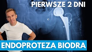 ENDOPROTEZA BIODRA co robić po OPERACJI [upl. by Hilar283]