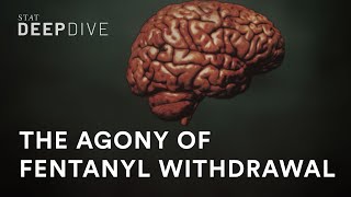 Why fentanyl withdrawal is so unbearable [upl. by Vasta]