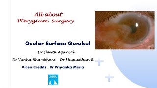 All about Pterygium SurgeryAnimated [upl. by Mckale]