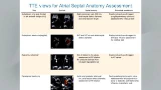 Guidelines for the Echocardiographic Assessment of Atrial Septal Defect amp Patent Foramen Ovale [upl. by Merwin742]