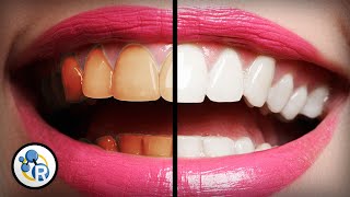 Whats The Best Way To Whiten Teeth [upl. by Carissa]