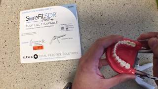 Demo SureFil SDR Flow bulkfill composite from Dentsply Sirona [upl. by Gaylene]