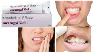 Metrogyl DG Gel Forte Use to teeth bacterial infection [upl. by Attelahs]