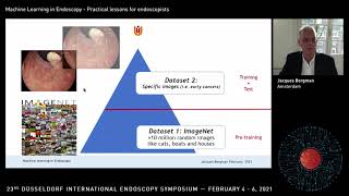 Machine learning in endoscopy  Bergman [upl. by Anuait]