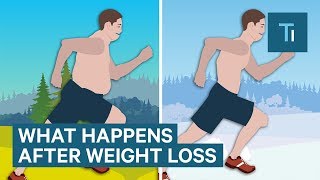 What Losing Weight Does To Your Body And Brain  The Human Body [upl. by Yerahcaz166]