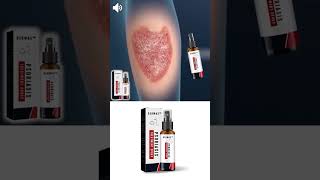 South Moon™ Psoriasis Treatment Spray [upl. by Hellene]