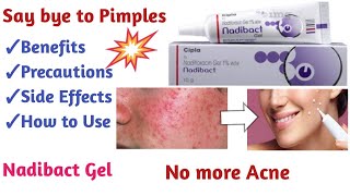 How to get rid of Pimples or acne Nadibact cream review [upl. by Ofori]