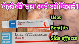 Melalite 15 Cream Benifits  Use  Side effects  Full Review in Hindi [upl. by Burns291]