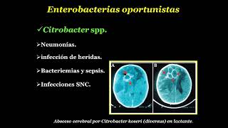 Enterobacterias oportunistas Acinetobacter spp [upl. by Terese]