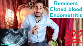 Level 3  Female pelvis  Obs  Emergency  Post abortion Reminent vs cloted blood [upl. by Damaris]