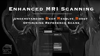 Enhanced MRI Scanning Understanding Deep Resolve Boost and Optimizing Reference Scans [upl. by Cynthie842]