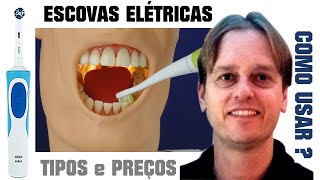 Escovas de Dente Elétricas São Boas Tipos Preços e Como Usar [upl. by Thibaut]