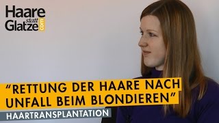 Nach Verätzung beim Blondieren Haarverpflanzung rettete die Haare [upl. by Valdes]