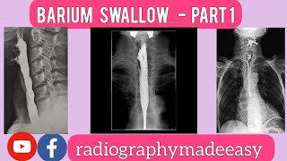 Barium Swallow  Part 1  Clinical Indications  GIT System  By Aaqib Bhat [upl. by Laekim661]