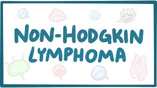 Nonhodgkin lymphoma  causes symptoms diagnosis treatment pathology [upl. by Aros]