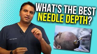 Dermarolling Optimal Needle Depth  The Hair Loss Show [upl. by Nylasoj750]