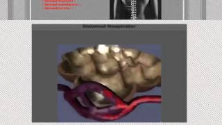 Atestat informatica  Anatomia umana [upl. by Soilissav]