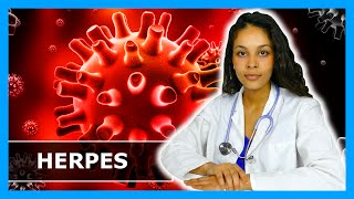 HERPES  WAS TUN Fieberbläschen wieder loswerden  Lippenherpes behandeln amp vorbeugen [upl. by Feinstein701]