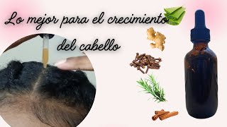 REMEDIO CASERO PARA CRECER EL CABELLO MÁS RÁPIDO [upl. by Eirotal890]