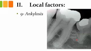 orthodontics L13 etiology of malocclusion 4 [upl. by Lunette375]