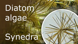 All About Diatom Algae Synedra in the Aquarium Description Causes and How to Get Rid of It [upl. by Adaline782]