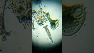 Stentors and Rotifers [upl. by Aniraz298]