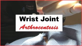 Wrist Joint Arthrocentesis Procedure [upl. by Anneres355]