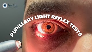 Pupillary Light Reflex Tests [upl. by Yuille]