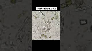 ➡️ Trichostrongylus Ova microbiology parasite [upl. by Savdeep]