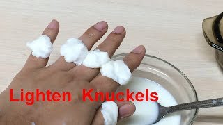 How to lighten knuckels and toes naturally [upl. by Jacinto]