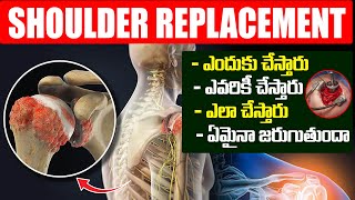 Shoulder Replacement Surgery in Telugu  Shoulder Pain in tealugu HitTVHealthtips shoulderpain [upl. by Maye210]